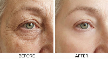 The “Calcium-Infused” Roller That Tightens “Crepey” Eyelids Without Surgery