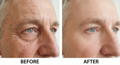 The “Calcium-Infused” Roller That Tightens “Crepey” Eyelids Without Surgery