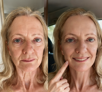 The “Calcium-Infused” Roller That Tightens “Crepey” Eyelids Without Surgery